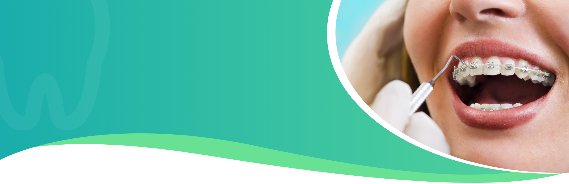 Post Graduate Diploma in Clinical Orthodontics IMMO